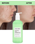 Gel Limpiador Facial Purificante (200ml)