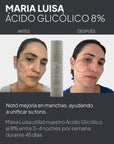 Kit Renovador (Retinal al 0.1% + Ácido Glicólico al 8%)
